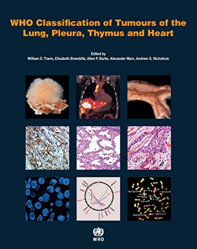 Beispielbild fr WHO Classification of Tumours of the Lung, Pleura, Thymus and Heart (IARC WHO Classification of Tumours) zum Verkauf von Books From California
