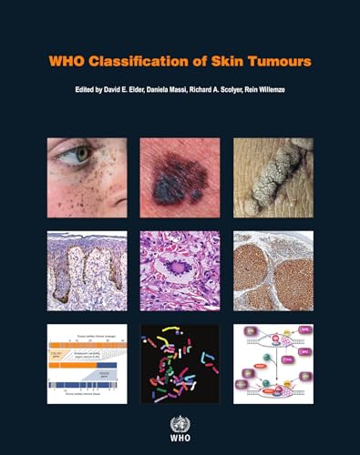 Stock image for WHO Classification of Skin Tumours for sale by Books Puddle