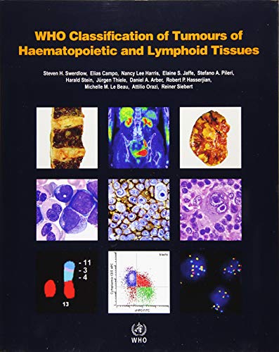 Beispielbild fr WHO Classification of Tumours of Haematopoietic and Lymphoid Tissues zum Verkauf von BooksRun
