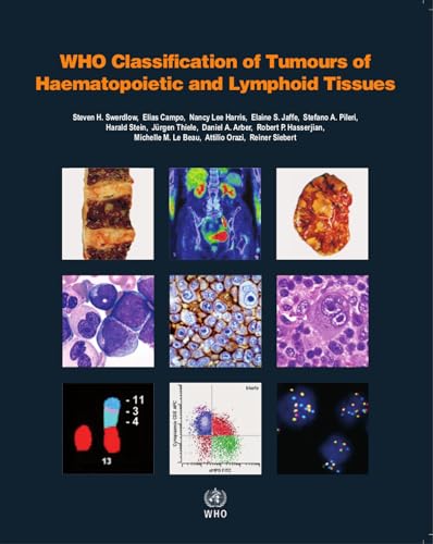 9789283244943: WHO Classification of Tumours of Haematopoietic and Lymphoid Tissues