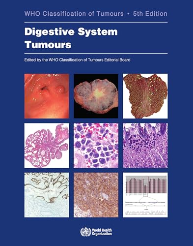 Stock image for Digestive System Tumours for sale by Books Puddle