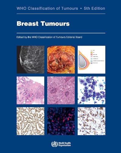 Stock image for Breast Tumours (Medicine) for sale by Books Puddle