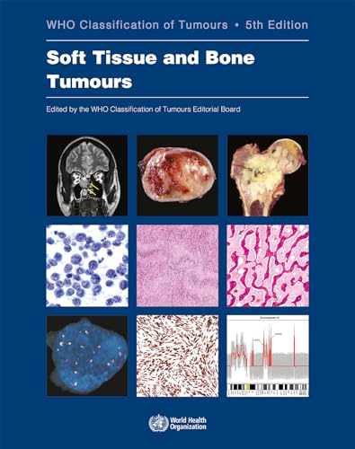 9789283245025: Soft Tissue and Bone Tumours: 3