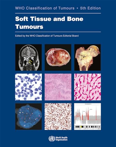 9789283245025: Soft Tissue and Bone Tumours: WHO Classification of Tumours (Medicine)