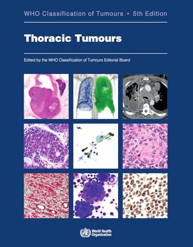 Stock image for Thoracic tumours for sale by Books Puddle