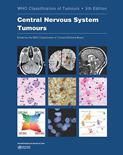 9789283245087: Central Nervous System Tumours
