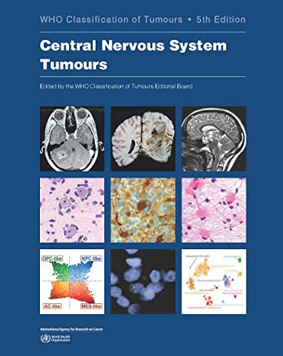 9789283245087: Central Nervous System Tumours: WHO Classification of Tumours