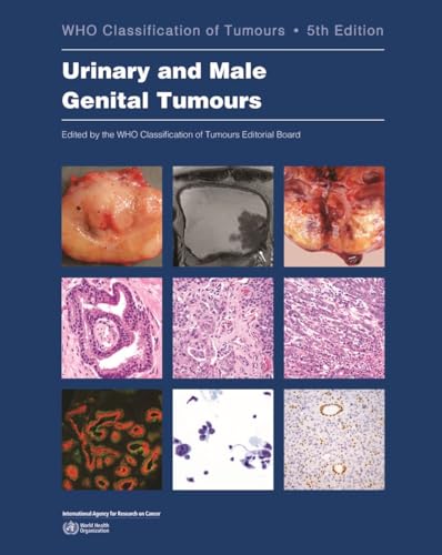 Stock image for Urinary and Male Genital Tumours for sale by Books Puddle