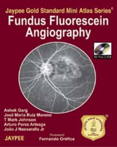 Imagen de archivo de Fundus Flourescein Angiography a la venta por Books Puddle