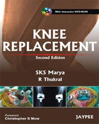 Stock image for Knee Replacement for sale by Anybook.com