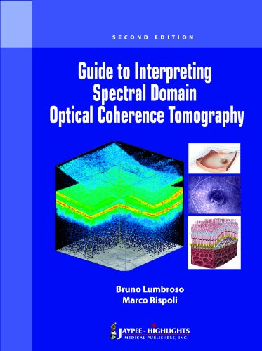 Beispielbild fr Guide to Interpreting Spectral Domain Optical Coherence Tomography zum Verkauf von Better World Books