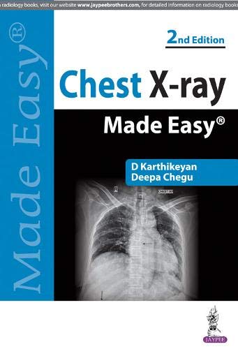 Beispielbild fr Chest X-Ray Made Easy zum Verkauf von Books Puddle