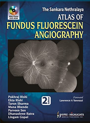 Beispielbild fr The Sankara Nethralaya Atlas of Fundus Fluorescein Angiography zum Verkauf von Books Puddle