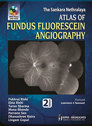 Stock image for THE SANKARA NETHRALAYA ATLAS OF FUNDUS FLUORESCEIN ANGIOGRAPHY WITH PHOTO DVD-ROM for sale by Basi6 International