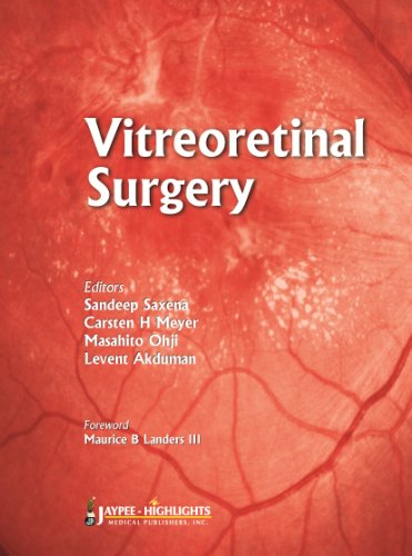 Beispielbild fr Vitreoretinal Surgery zum Verkauf von Reuseabook