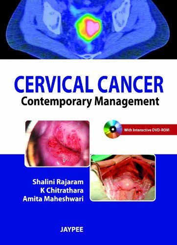 9789350255827: Cervical Cancer: Contemporary Management