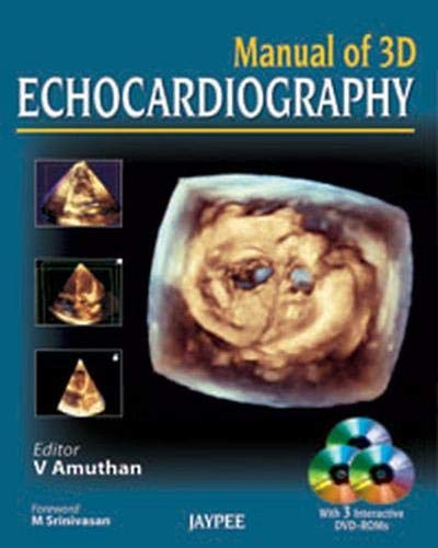 Stock image for Manual of 3D Echocardiography for sale by Chiron Media