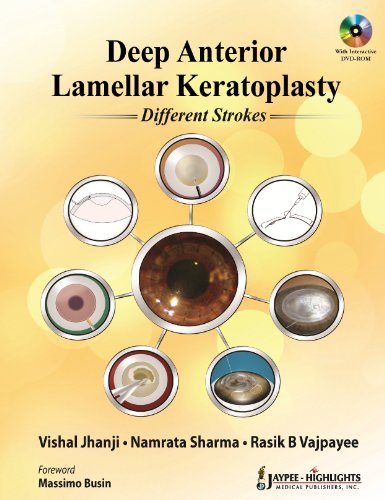 9789350256329: Deep Anterior Lamellar Keratoplasty Different Strokes