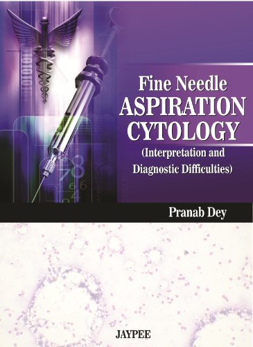 Stock image for Fine Needle Aspiration Cytology: Interpretation and Diagnostic Difficulties for sale by Mispah books