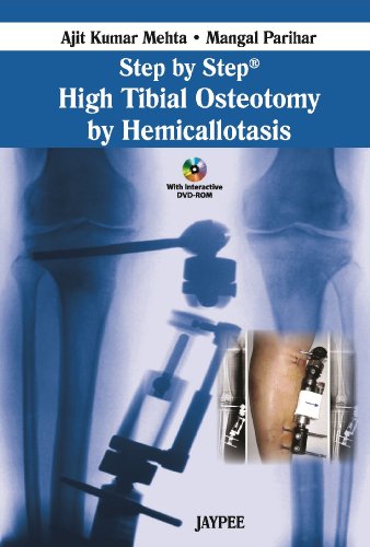 9789350256466: Step by Step High Tibial Osteotomy by Hemicallotasis