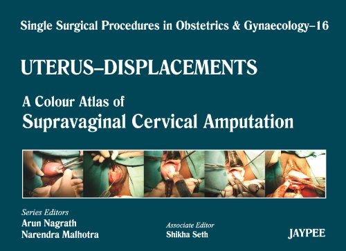 Imagen de archivo de A COLOUR ATLAS OF SUPRAVAGINAL CERVICAL AMPUTATION V-16 a la venta por Basi6 International