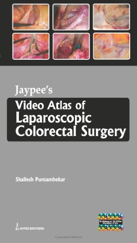 Stock image for Jaypee's Video Atlas of Laparoscopic Colorectal Surgery for sale by PBShop.store US