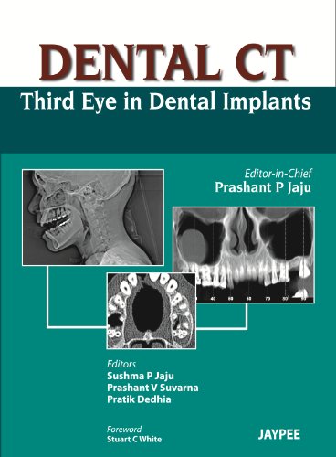 9789350259108: Dental CT: Third Eye in Dental Implants