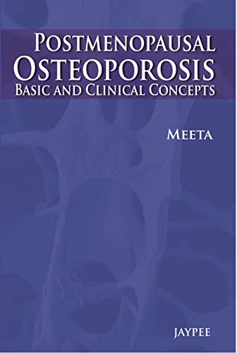 9789350900857: Post-Menopausal Osteoporosis