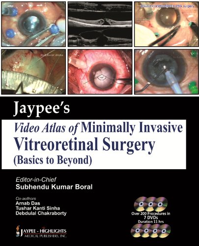 Stock image for JAYPEE VIDEO ATLAS OF MINIMALLY INVASIVE VITREORETINAL SURGERY for sale by Basi6 International