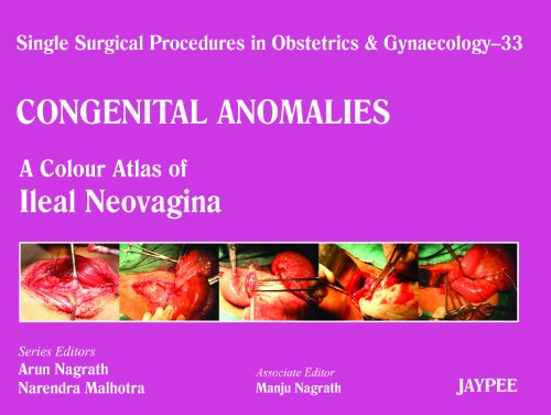 9789350902912: Vaginoplasty: A Colour Atlas of Ileal Neovagina (Single Surgical Procedures in Obstetrics and Gynaecology)