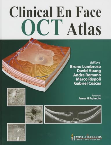 Stock image for CLINICAL EN FACE OCT ATLAS for sale by Basi6 International