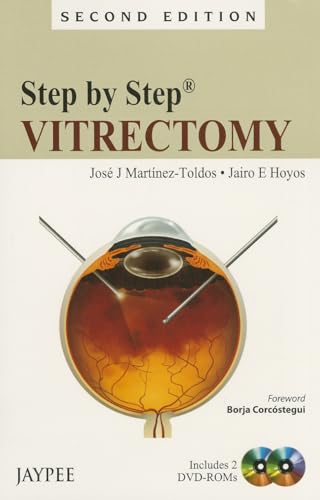 9789350903544: Step by Step: Vitrectomy