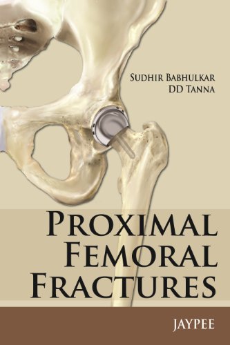Stock image for Proximal Femoral Fractures (Paperback) for sale by CitiRetail