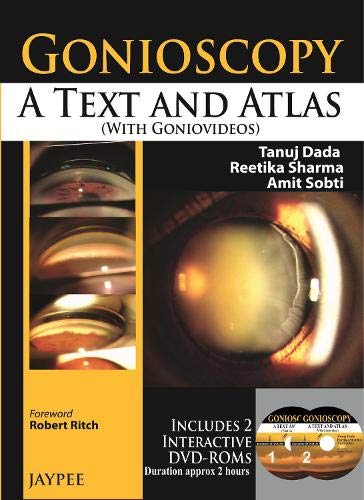 9789350904343: Gonioscopy: A Text and Atlas (with Goniovideos)
