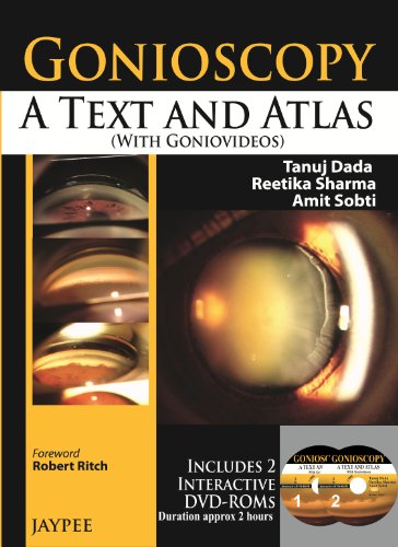 9789350904343: Gonioscopy: A Text and Atlas (With Goniovideos)