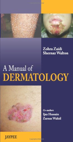 9789350904589: A Manual of Dermatology