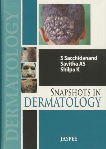 9789350904596: Snapshots in Dermatology