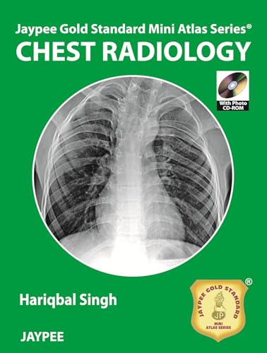 Beispielbild fr Jaypee Gold Standard Mini Atlas Series: Chest Radiology zum Verkauf von Buchpark