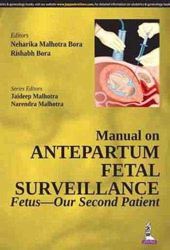 Beispielbild fr Manual on Antepartum Fetal Surveillance Fetus ? Our Second Patient zum Verkauf von Books Puddle