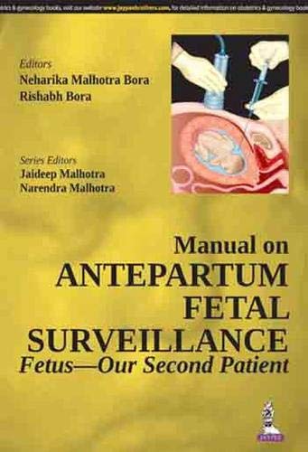 Imagen de archivo de Manual on Antepartum Fetal Surveillance Fetus ? Our Second Patient a la venta por Books Puddle