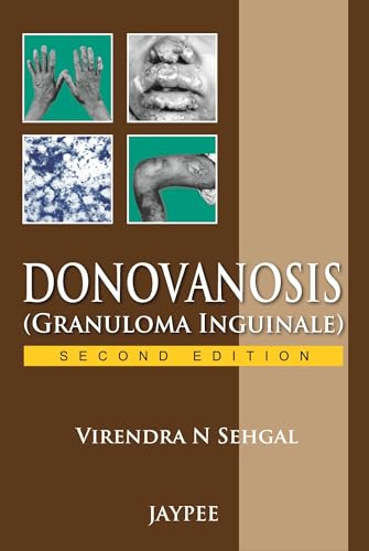 Stock image for Donovanosis, Granuloma Inguinale for sale by dsmbooks