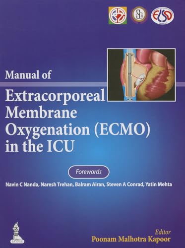 Stock image for Manual of Extracorporeal Membrane Oxygenation Ecmo in the ICU for sale by BGV Books LLC