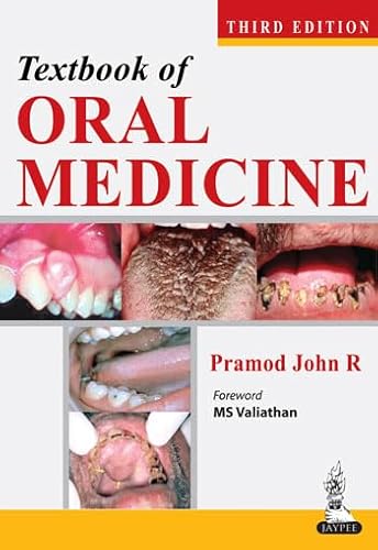 9789350908501: Textbook of Oral Medicine