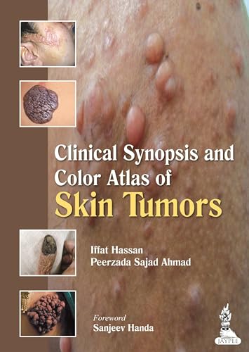 9789350909454: Clinical Synopsis and Color Atlas of Skin Tumors