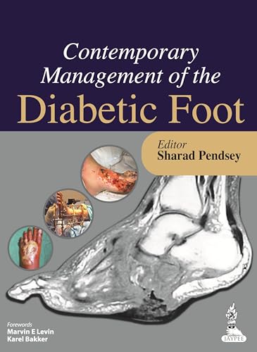 9789350909485: Contemporary Management of the Diabetic Foot