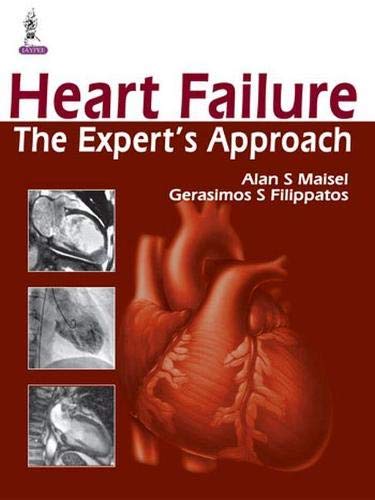 Beispielbild fr Heart Failure. The Expert's Approach zum Verkauf von Research Ink
