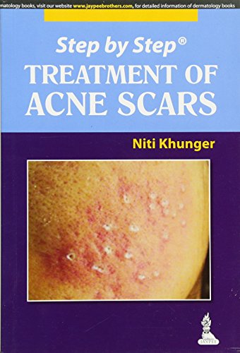 9789350909577: Step by Step Treatment of Acne Scars