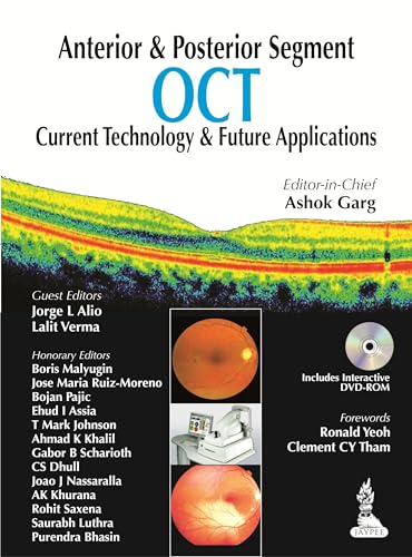 9789350909782: Anterior & Posterior Segment OCT: Current Technology & Future Applications