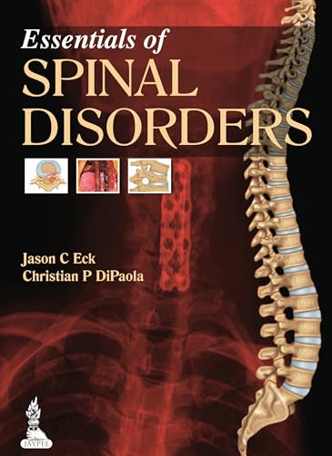 9789350909836: Essentials of Spinal Disorders