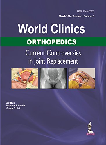 Beispielbild fr World Clinics: Orthopedics. Current Controversies in Joint Replacement zum Verkauf von Research Ink